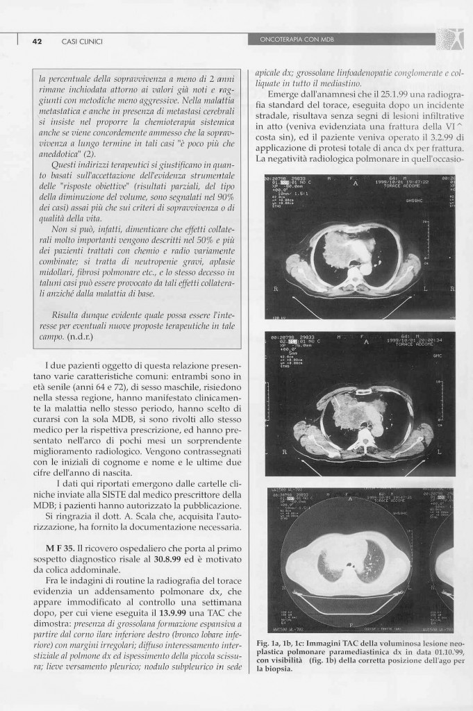 2-casi-carcinoma-polmonare-page-2.jpg