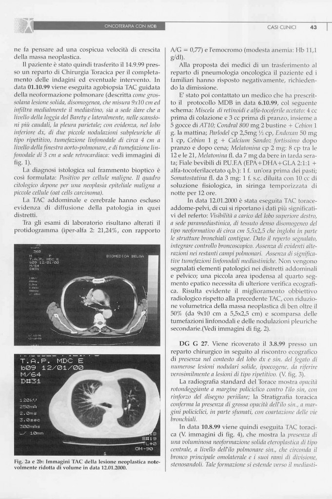 2-casi-carcinoma-polmonare-page-3.jpg