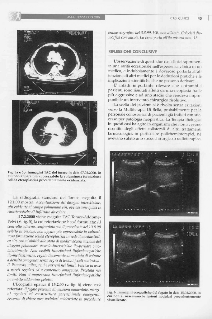 2-casi-carcinoma-polmonare-page-5.jpg