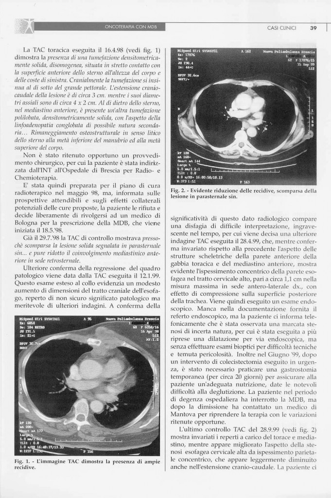 carcinoma-mammario-page-1.jpg