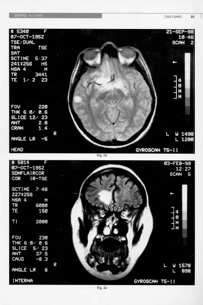 eteroplasia-cerebrale-n.a.s.-page-3.jpg