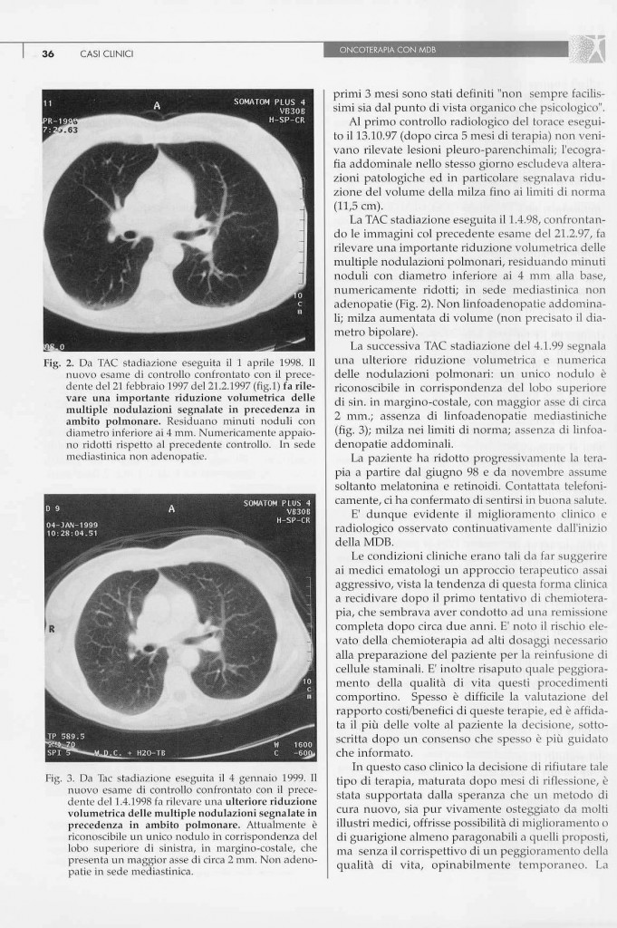 linfoma-non-hodgkin-follicolare-page-2.jpg