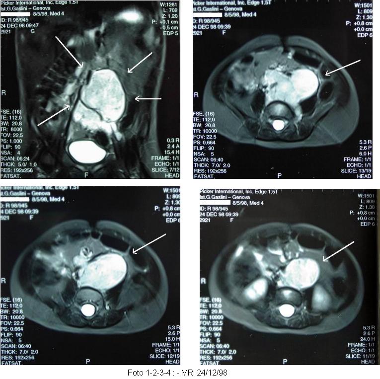 neuroblas.-1-2-3.jpg