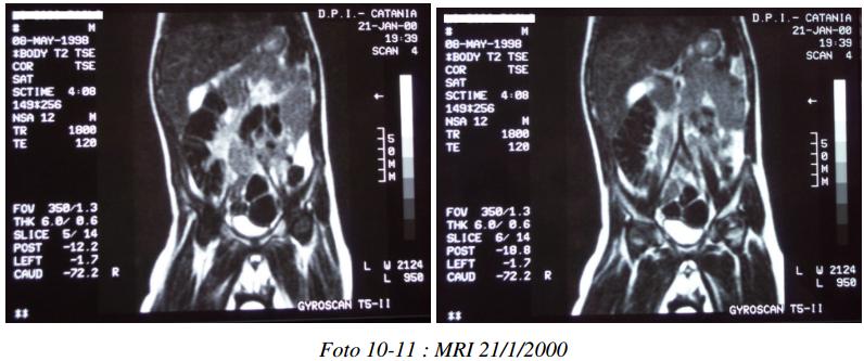 neuroblas.-10.jpg