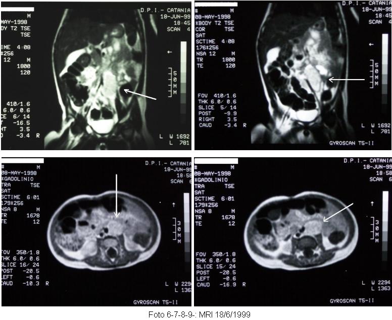 neuroblas.-6-7-8.jpg