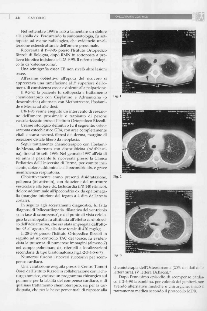 sarcoma-osteogenico-page-1.jpg