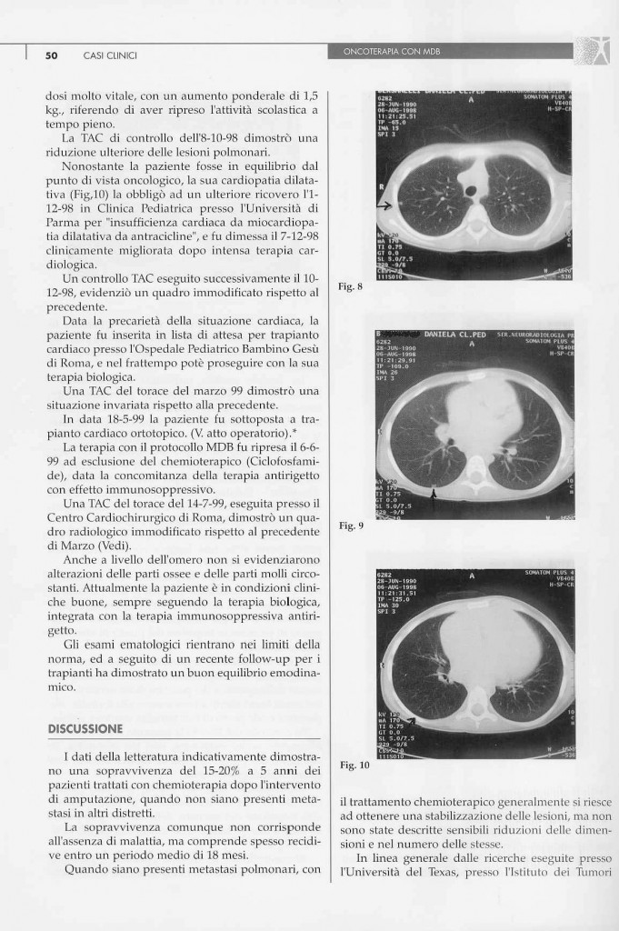 sarcoma-osteogenico-page-3.jpg